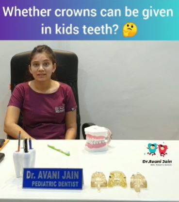 Whether crowns can be given in kids teeth ? Know your answers!