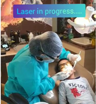Laser Pediatric dentistry